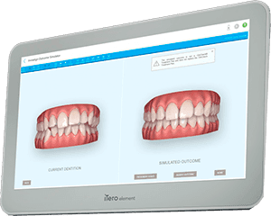 iTero invisalign serra negra